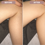 Ceralia™ SilkShave