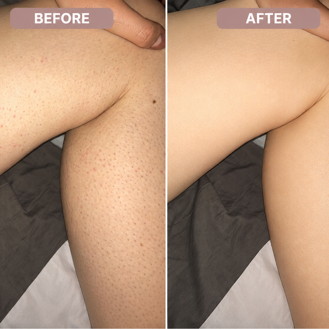 Ceralia™ SilkShave